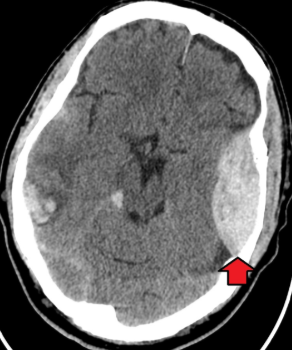 <p>what is the diagnosis?</p>