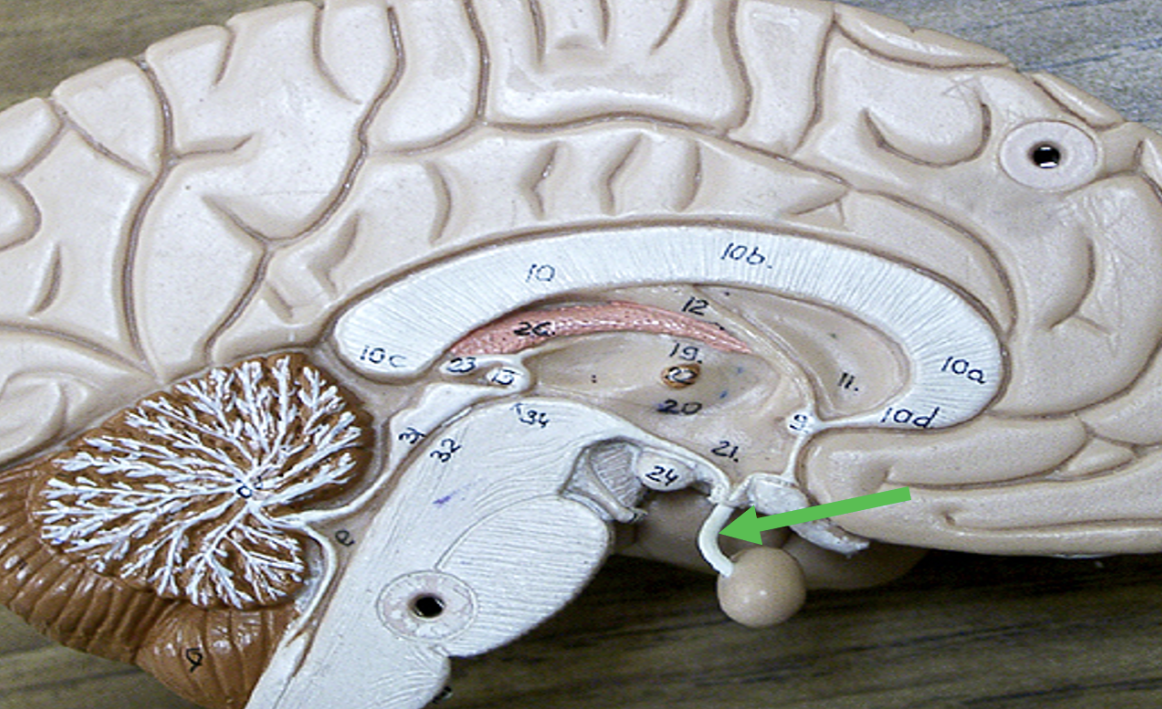 <p>Identify the area of the brain indicated by the pointer.</p>