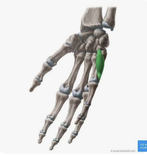 <p>A: Opposition of digit 5</p><p>N: Ulnar nerve</p>