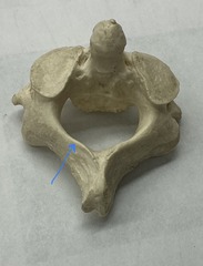 <p>What is the arrow pointing to?</p>