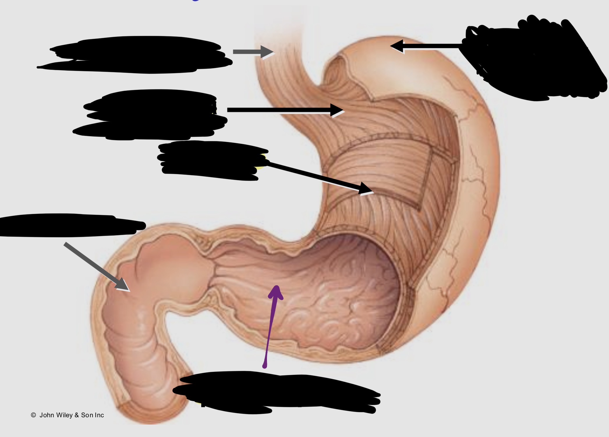 <p>Label the stomach</p>
