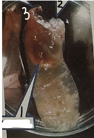 <p>point 3 on this tunicate</p>