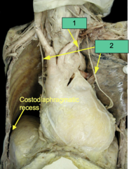 <p>What nerve is shown at #2?</p>