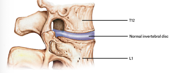 <p>A wide symphysis located between the bodies of adjacent vertebrae of the vertebral column. </p><ul><li><p>Filled with <span style="color: rgb(77, 155, 203);">Intervertebral Discs</span>. </p></li><li><p>Important for carrying heavy objects, high impact activities. (Running/Jumping)</p></li></ul><p></p>