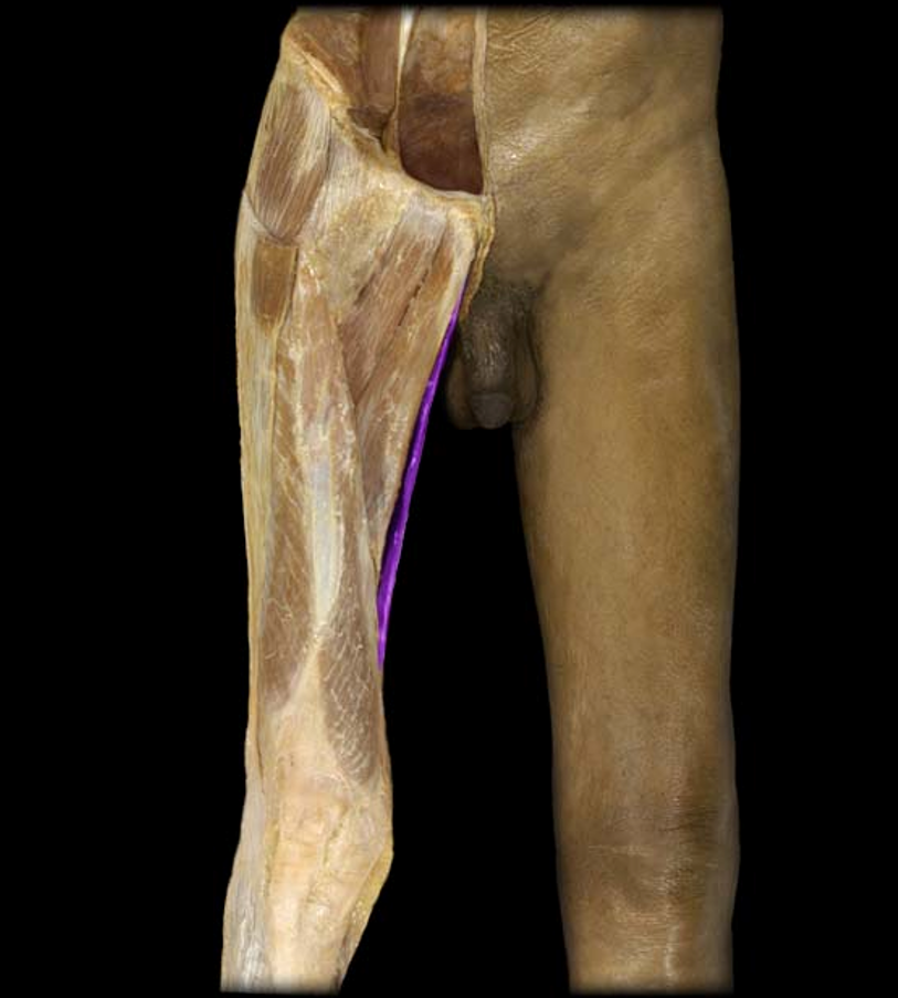 <p>What muscle is this?</p>