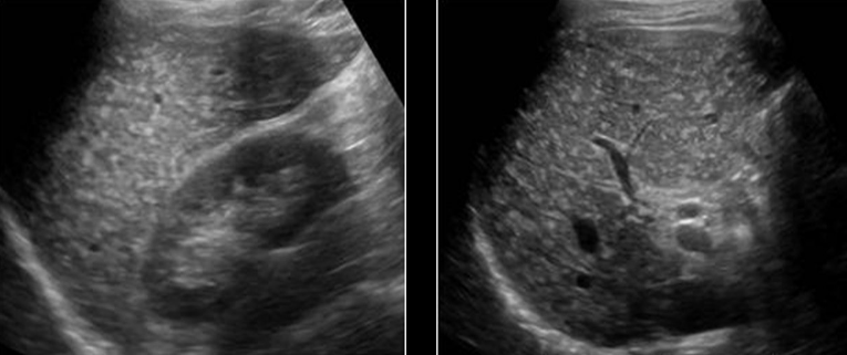 <p>Identify this image. </p>