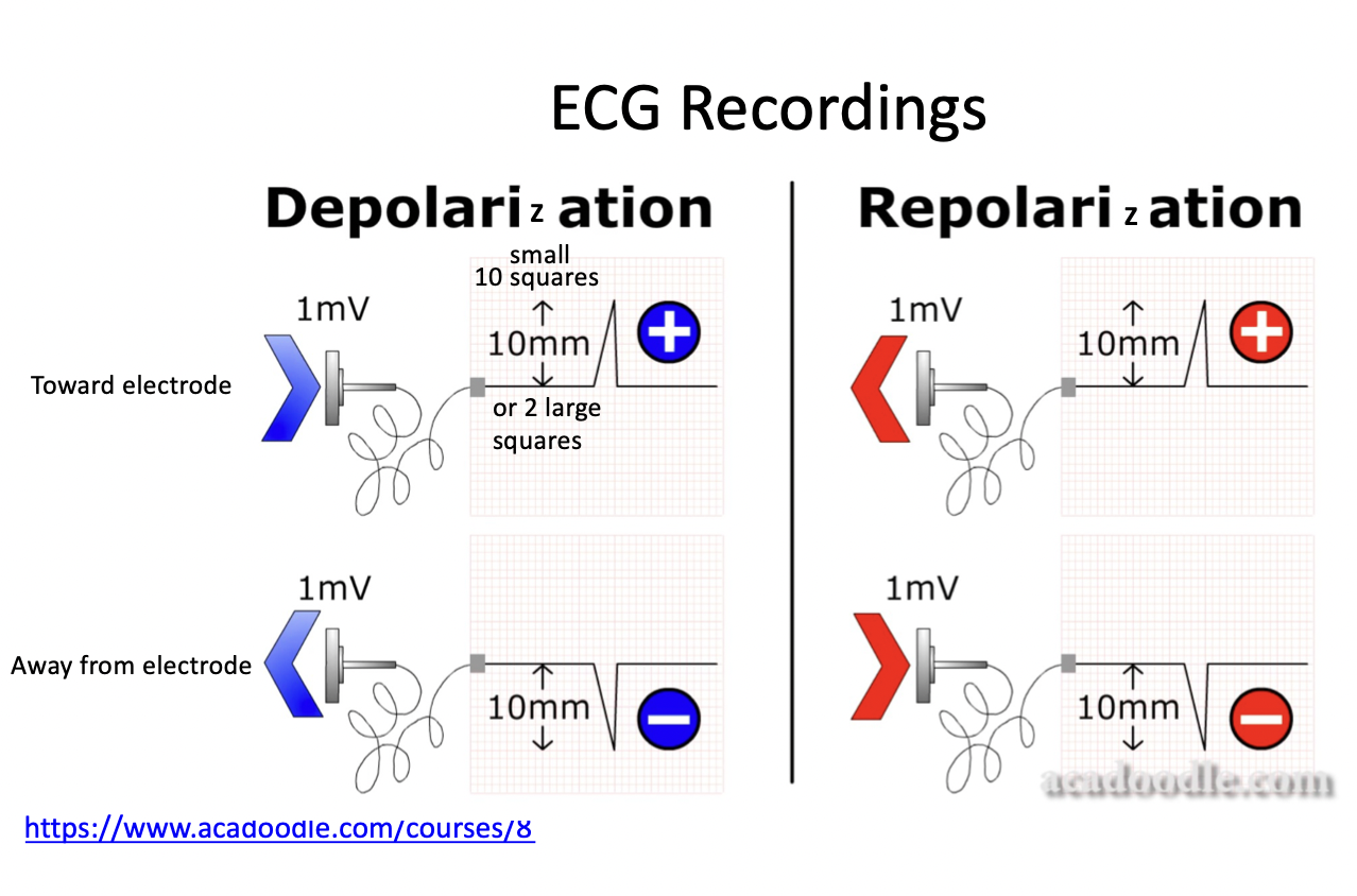 <p>Depolarization toward an electrode - positive spike </p><p>Repolarization away from an electrode - positive spike</p>