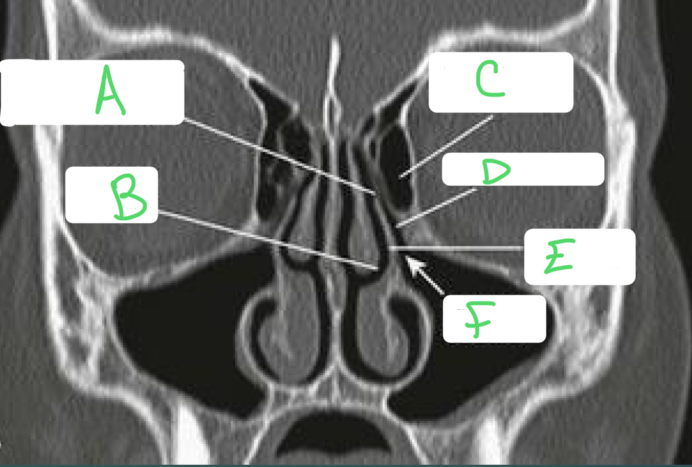 <p>d?</p>