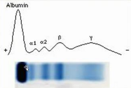 <p>___ gives a graph showing the concentration of different proteins (globulins) in an electrophoretogram.</p>