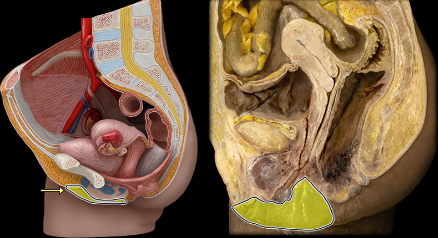 <p>what part of the female pelvis is this</p>