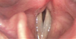 <p>what? (shows at close)</p>