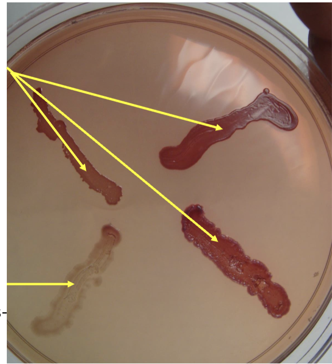 <p>what type of agar is it?</p>