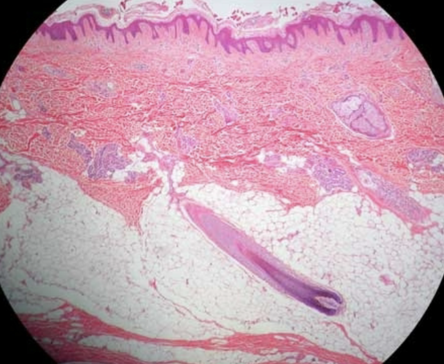 <p>What is that tadpole looking thing neat the bottom left of the image?</p>