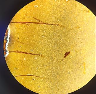 <p>Cerebrum - AgNO3</p><ul><li><p><strong>Purpose:</strong> Used because <strong>astrocytes</strong> have an affinity for gold.</p></li><li><p><strong>Visuals:</strong> Astrocytes look like "<strong>spiders or like stars</strong>".</p></li><li><p><strong>Color:</strong> Appears as a "<strong>pink purple structure</strong>" even though gold is used.</p></li></ul><p></p>