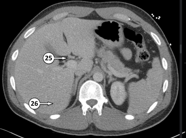 <p>Label 25 and 26 </p>