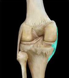<p>external to joint capsule</p>