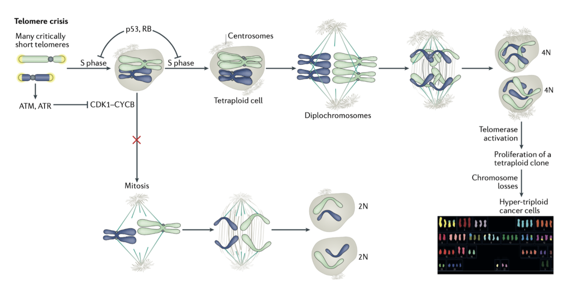 <p>Telomere crisis can lead to persistent DDR signalling</p><ul><li><p>eg. ATM/ATR results in prolonged CDK1-CyclinB inhibition > blocked entry to mitosis</p></li></ul><p>Cells can overcome this blockade by bypassing requirements of mitosis > undergo a second S phase</p><ul><li><p>this results in tetraploidy (diplochromosomes) due to double DNA replication and no mitosis > frequently observed in cancer </p></li></ul><p></p>