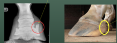 <p>what is the main function of collateral cartilages</p>