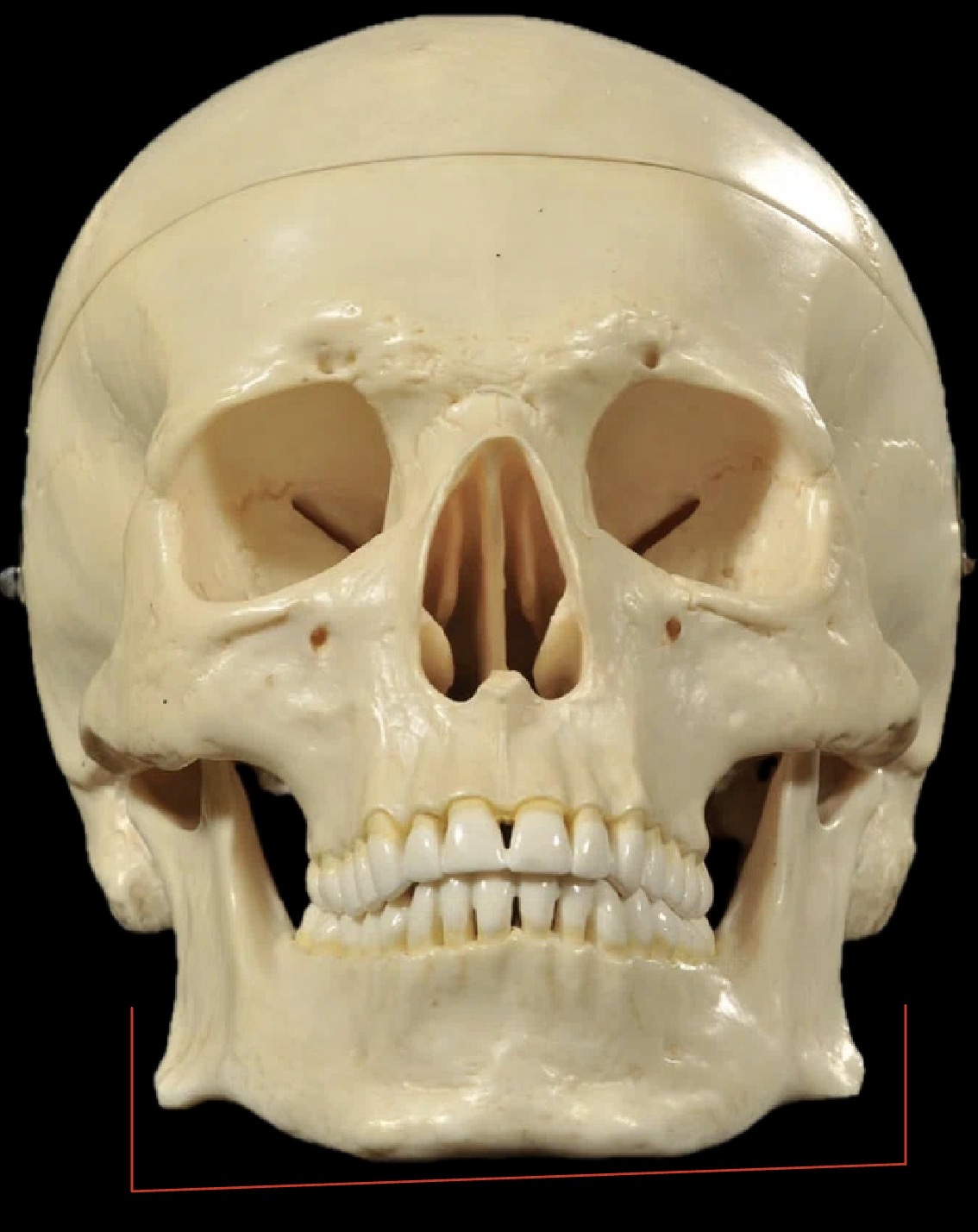 <p>What bone is this?</p>