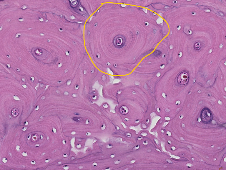 <p><span style="font-family: "Calibri Light";">This is the diaphysis (shaft) of a long bone in transverse (cross) section. <br>ID the encircled structural unit of mature bone.</span></p>