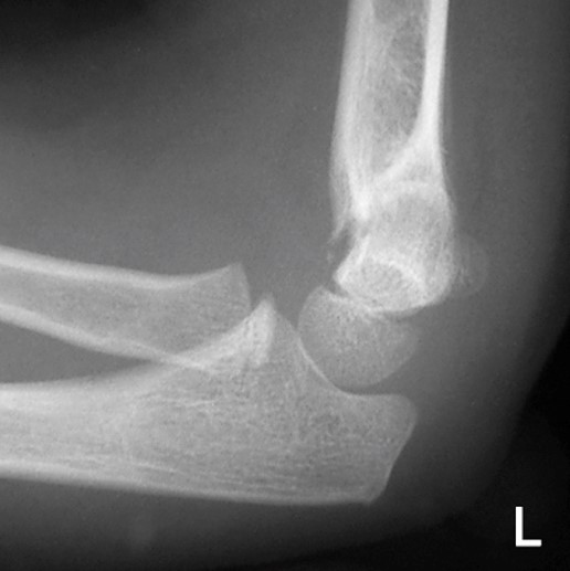 <p>What is the diagnosis?</p>
