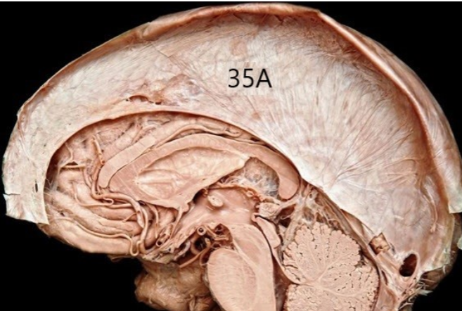 <p>What Type of Tissue is this made of?</p>