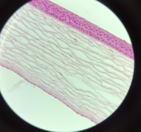 <p>Cornea Stratified Squamous Nonkeratinized - HE (1)</p><ul><li><p>Arch Structure</p></li><li><p>Cornea epithelium - Stratified squamous nonkeratinized</p></li><li><p>usually 6-7 layers of cells</p></li><li><p>Endothelium - origin Endothel<br>- epithelium anterius- stratified squamous non keratinized<br>- epithelium posterius- simple squamous epithelium</p></li></ul><p></p><ol><li><p>Basal Layer - Basal membrane is a straight line (has no blood vessels)</p></li><li><p>Stratum germinativum</p></li><li><p>Stratum basale</p></li><li><p>1-2 layers polygonal cells</p></li><li><p>1-2 layers of flat squamous cells</p></li></ol><p></p>