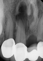 <ol start="82"><li><p>Identify the finding shown.</p></li></ol><p></p>