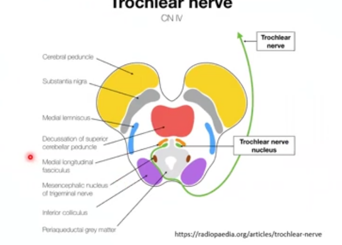 <p>trochlear nerve CN IV</p>