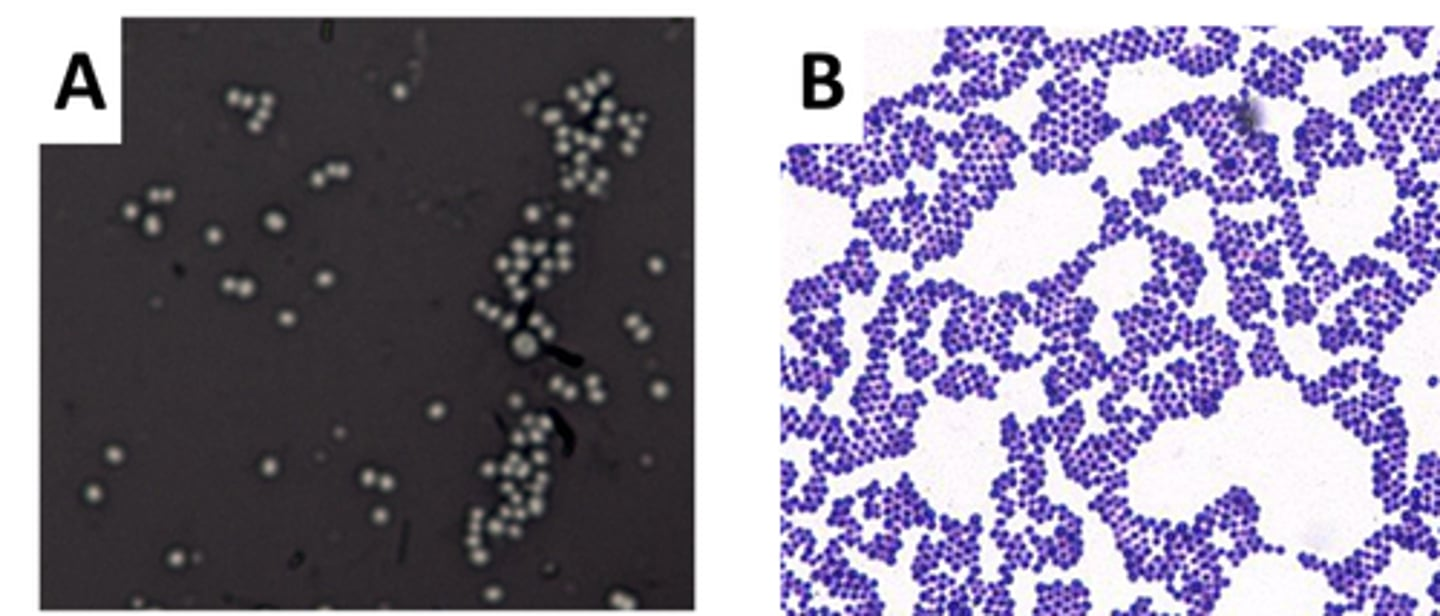 <p>The following represent the results of two staining protocols. Which has been stained with nigrosin?</p><p>A. Stain A</p><p>B. Stain B</p><p>C. Neither stain A or stain B</p><p>D. Both stain A or stain B</p>