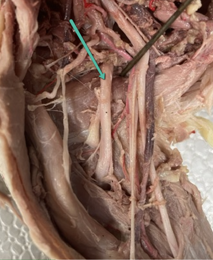 <p><span>Identify the nerve/cord indicated by the pointer.</span></p>