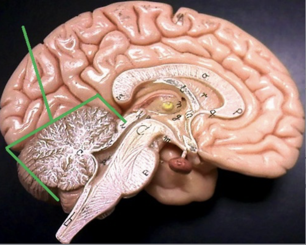 <p>passageway between third and fourth ventricles for CSF</p>