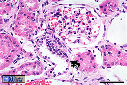 <p><span><span>The black arrow is pointing to cells in the ascending limb of the loop of Henle.</span></span><br><span><span>What are these cells called?</span></span></p>