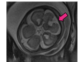 <p>What does this image represent?</p>