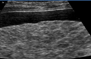 <p>describe this image and what is the dx</p>