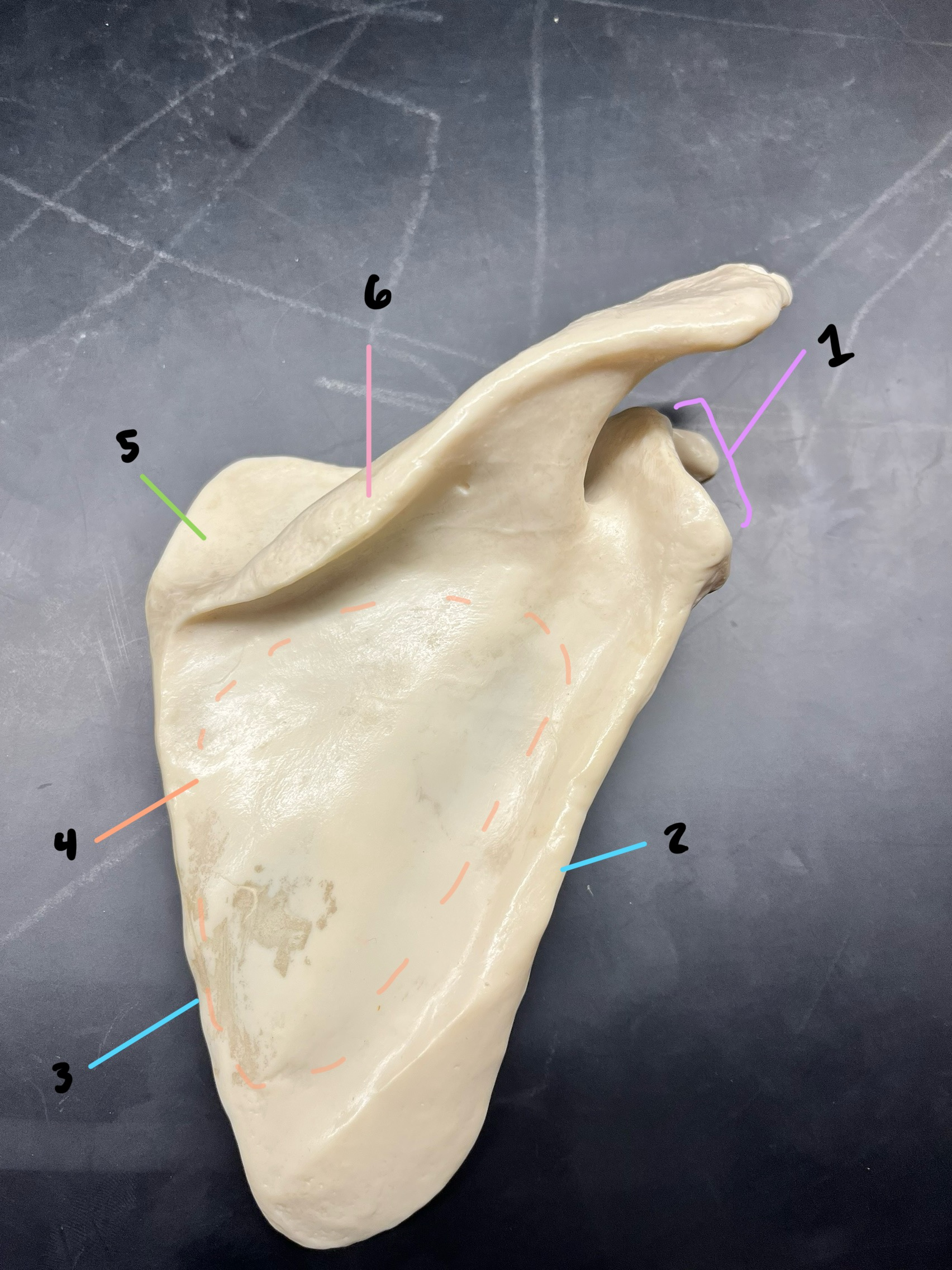 <p>what bone is this? give which side and if its anterior or posterior</p>