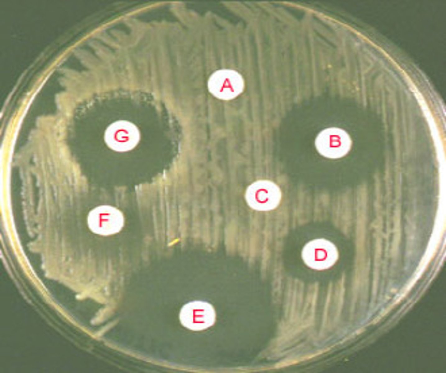 <p>simple, rapid method for determining susceptibility and resistance of a bacterial pathogen to antibacterial drugs. The test involves drug-impregnated disks placed on an agar plate inoculated with a bacterial lawn</p>
