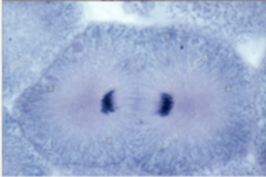 <p>Identify the Stage of Mitosis</p>