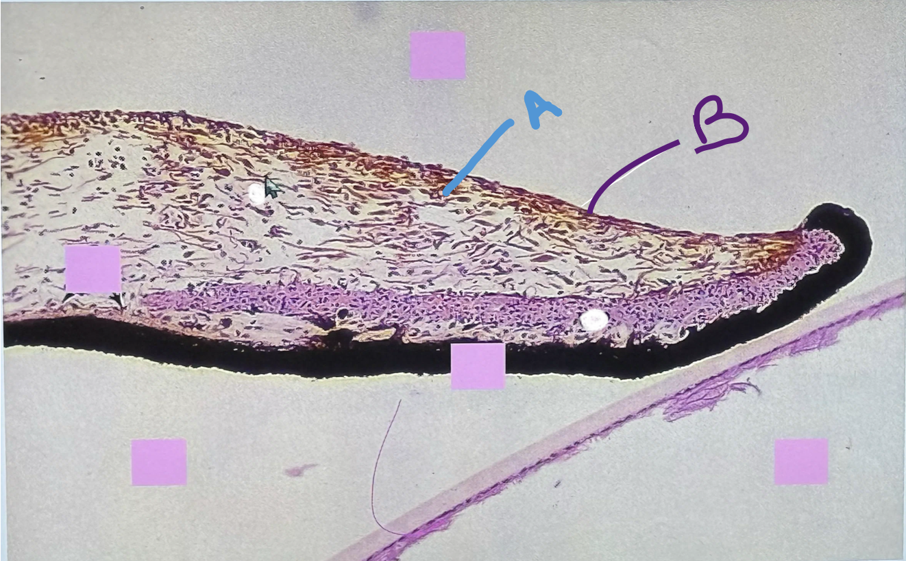 <p>What is A? (tissue type only)</p>