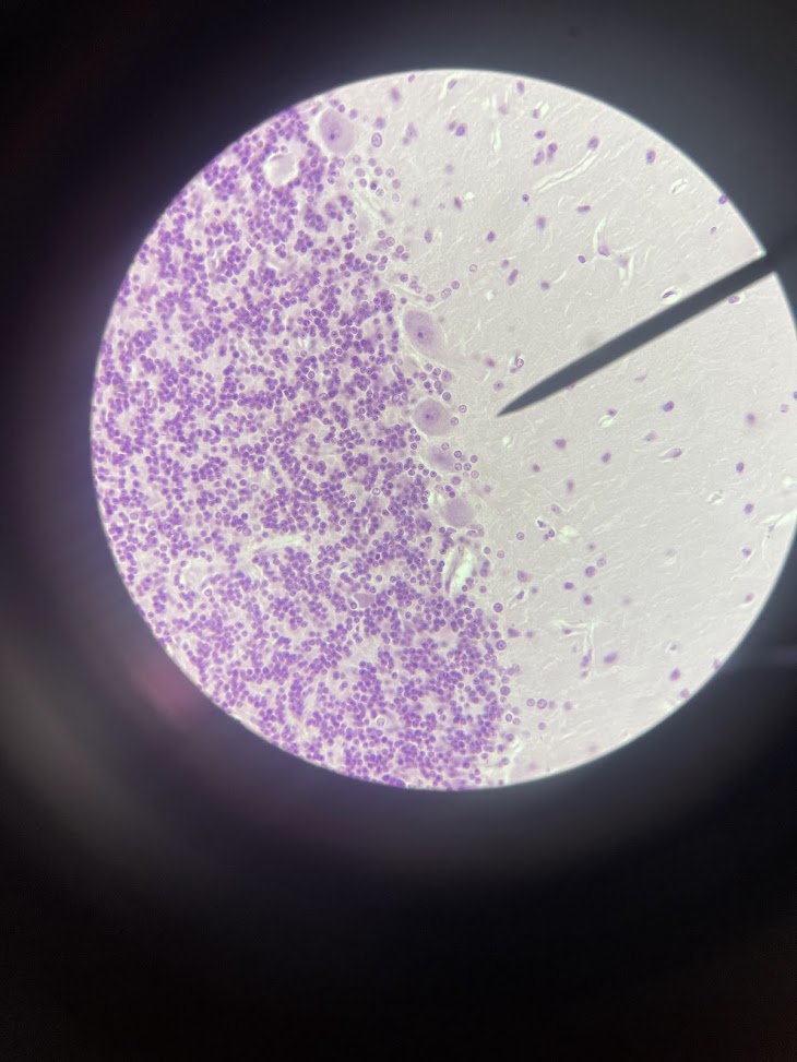 <p>tissue type + name (cerebellum)</p>