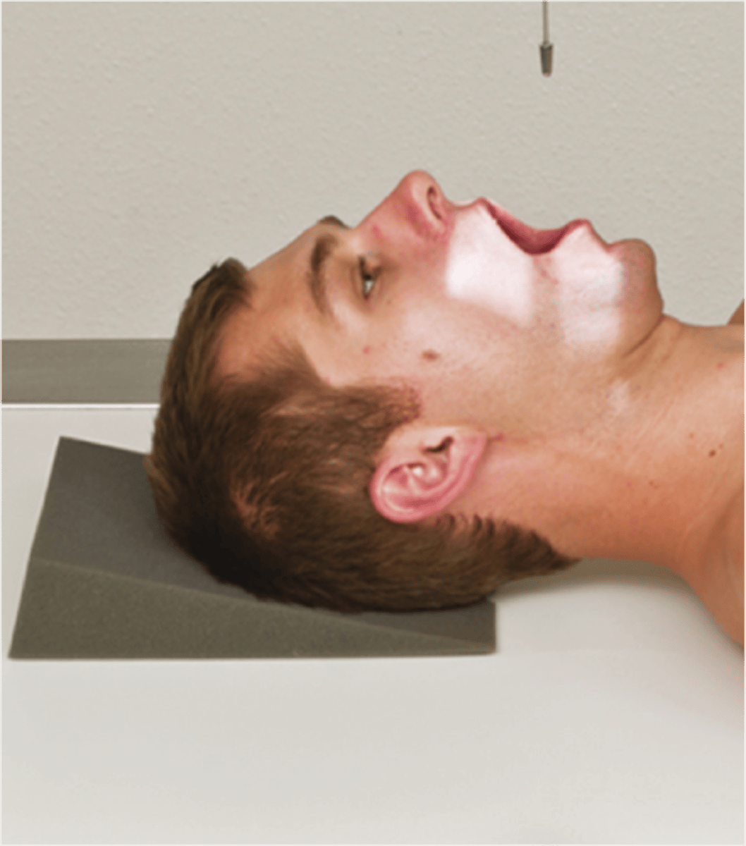 <p>S - around waist</p><p>T - 40 mAs @ 75 kVp</p><p>A - none</p><p>M - correct marker on correct side</p><p>P - back to board w/ base of skull & bottom of teeth lined up, CR center of mouth</p><p>S - 40"</p><p>B - suspension</p><p>C - 10 by 12</p>