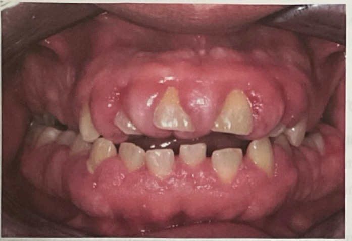 <p>CHẨN ĐOÁN?</p>