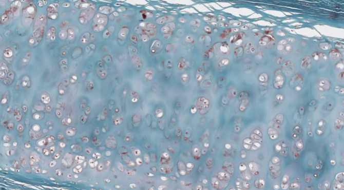<p>What tissue type is present?</p>