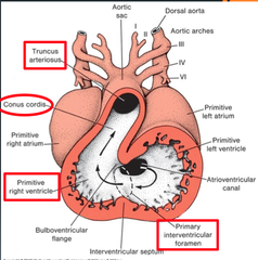 <p>develops into right ventricle</p>