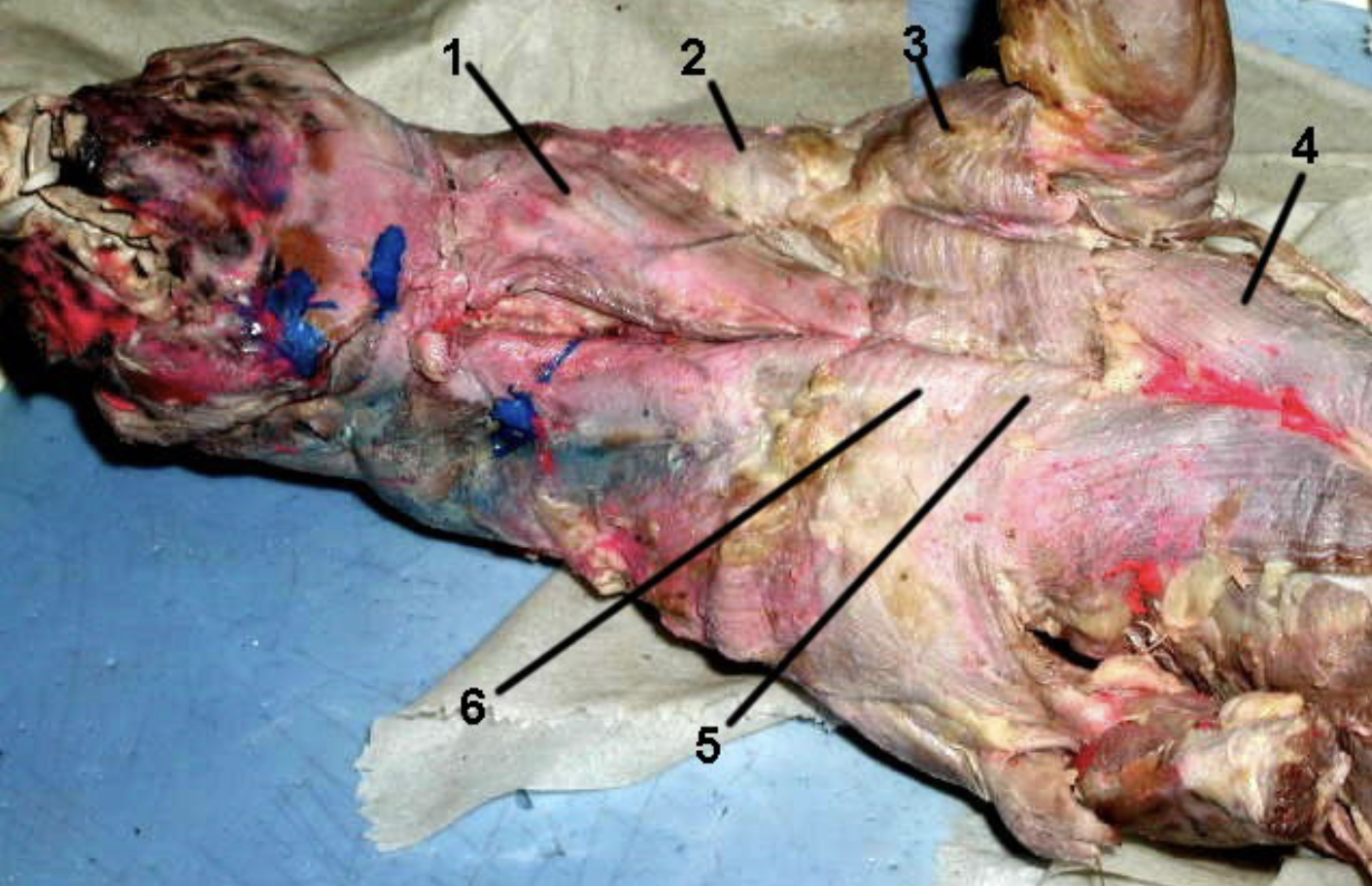 <p>Name muscle #6</p>