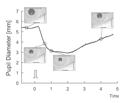 <p>pupils are <strong>slow </strong></p><ul><li><p>takes nearly a second for the pupil to constrict to about 90% of maximum </p></li><li><p>re-dilation is slower, not being able to complete even after <strong>3 seconds </strong></p></li><li><p><em>important for flashlight test!! Don’t want to go to quickly </em></p></li><li><p></p></li></ul><p></p>