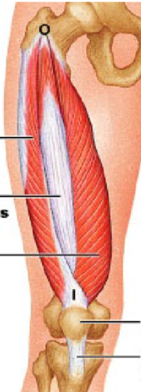 <p>vastus lateralis</p>