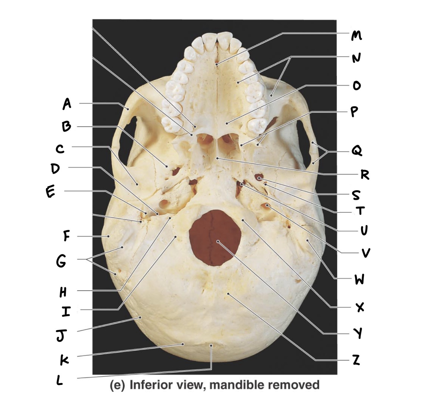 <p>M</p>