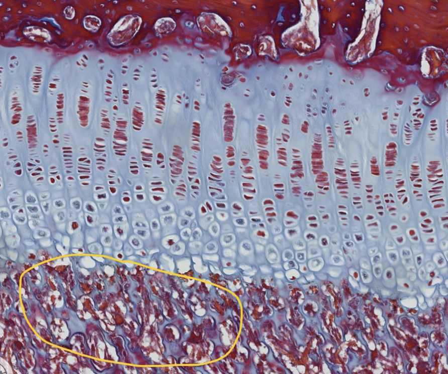 <p>Layers of the physis: which specific zone is encircled?</p>
