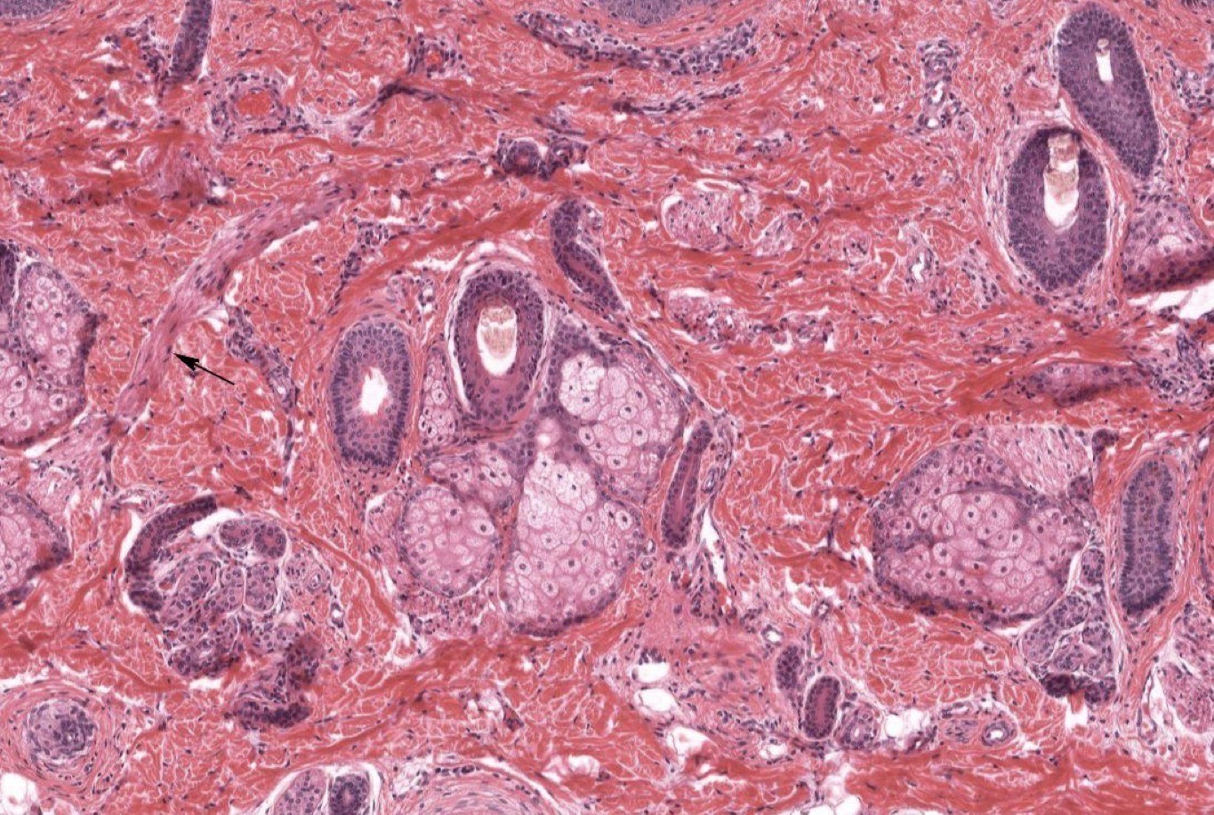 <p>Identify the Structure in the middle</p>